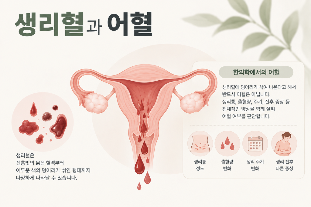 생리혈과 어혈